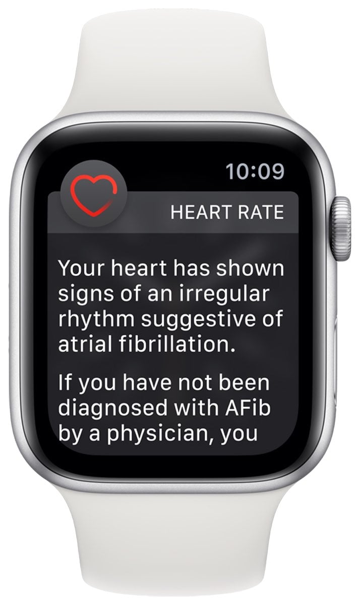 An image showing an irregular heart rate notification displayed on an Apple Watch