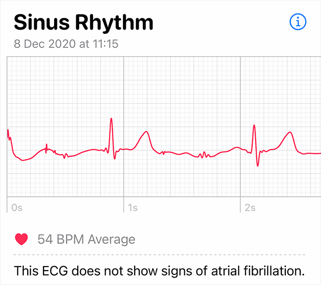 the authors nice normal heart rate rhythm